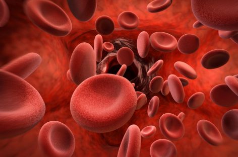 Medicament dezvoltat de Roche pentru tratamentul hemofiliei A, aprobat în UE