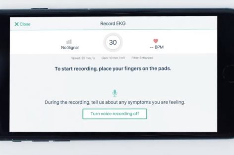 Un dispozitiv ce foloseşte inteligenţa artificială poate detecta afecţiuni folosind informaţiile din EKG