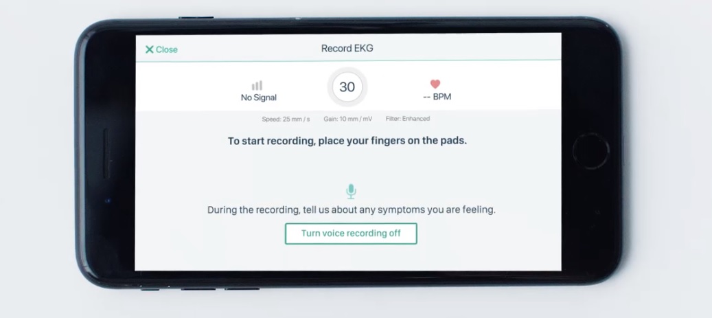 Un dispozitiv ce foloseşte inteligenţa artificială poate detecta afecţiuni folosind informaţiile din EKG