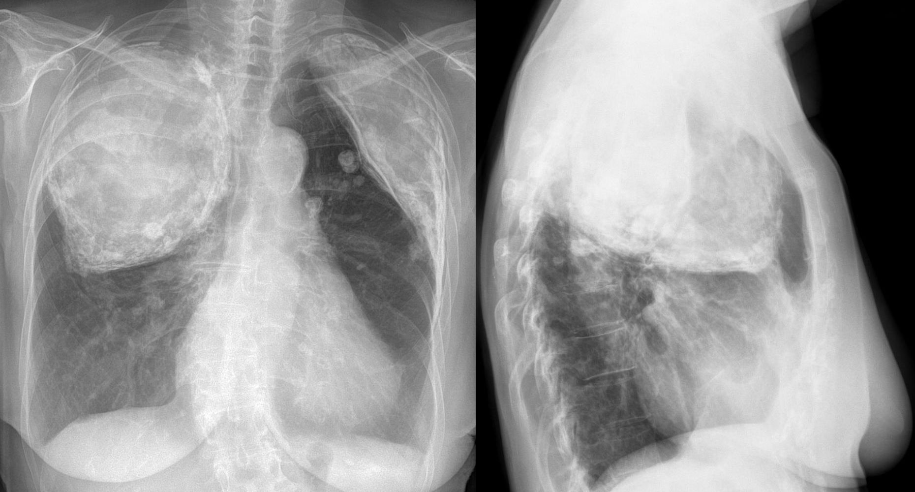 Ghidul naţional de management al cazurilor de tuberculoză chimiorezistentă a intrat în vigoare