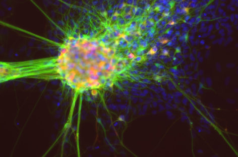 O echipă de cercetători din SUA a descoperit originea celulelor crestei neuronale, ce ar putea genera noi terapii cu celule stem regenerative