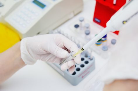 Furnizorii privaţi de servicii medicale critică măsura Ministerului Sănătăţii de a oferi prioritate laboratoarelor publice de testare