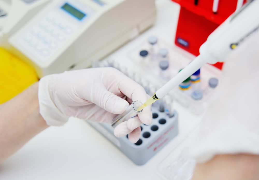[VIDEO] Dr. Andreea Alexandru, medic de laborator: Diagnosticul oricărei infecţii cu SARS-CoV-2 nu este exclusiv de laborator
