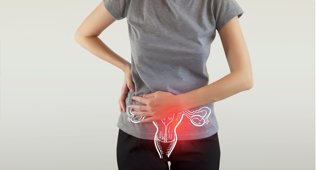 Îndepărtarea trompelor uterine pentru a evita cancerul ovarian