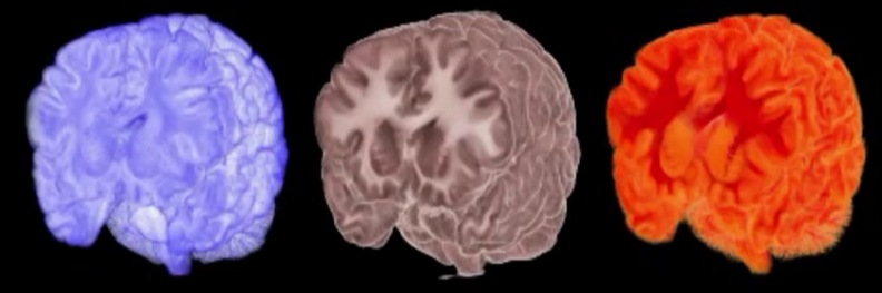 Oamenii de ştiinţă au creat o hartă 3D foarte detaliată a creierului uman