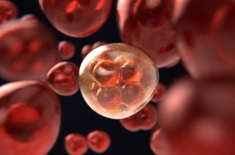 Aspect necunoscut al metabolismului cancerului