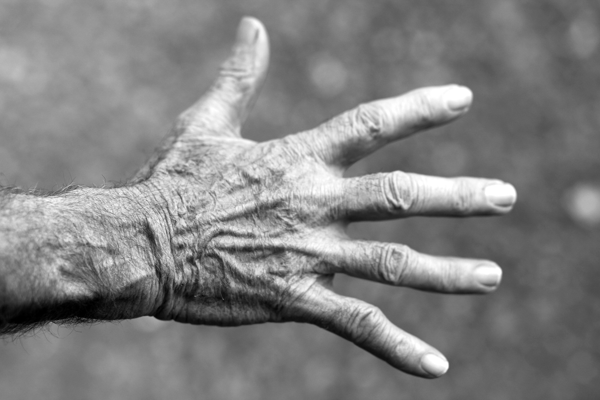 O variantă genetică comună identificată pentru sindromul de tunel carpian şi deget de declanşare
