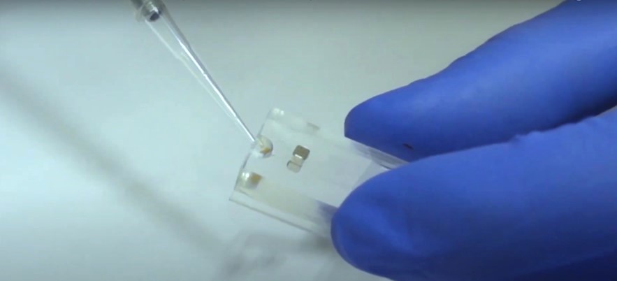 Test rapid şi precis pentru nivelul anticorpilor Covid-19, inventat de cercetători chinezi