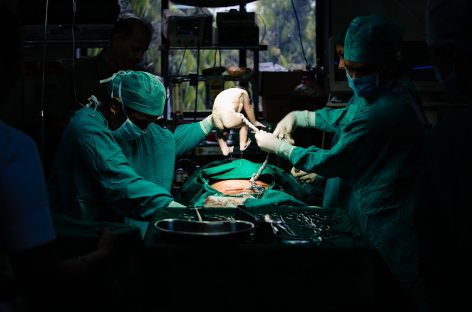 Naşterea prin cezariană creşte riscul fătului pentru boli cardiovasculare şi obezitate