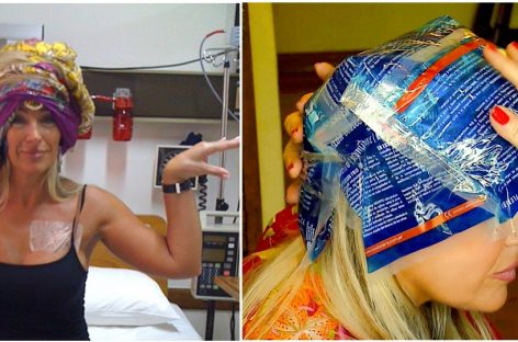 Cu o cască improvizată, o femeie din Argentina a reuşit să treacă prin chimioterapie fără să-şi piardă părul