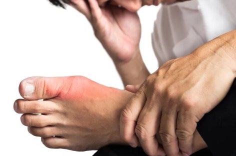 Risc de patru ori mai mare de infarct sau AVC imediat după o criză de gută