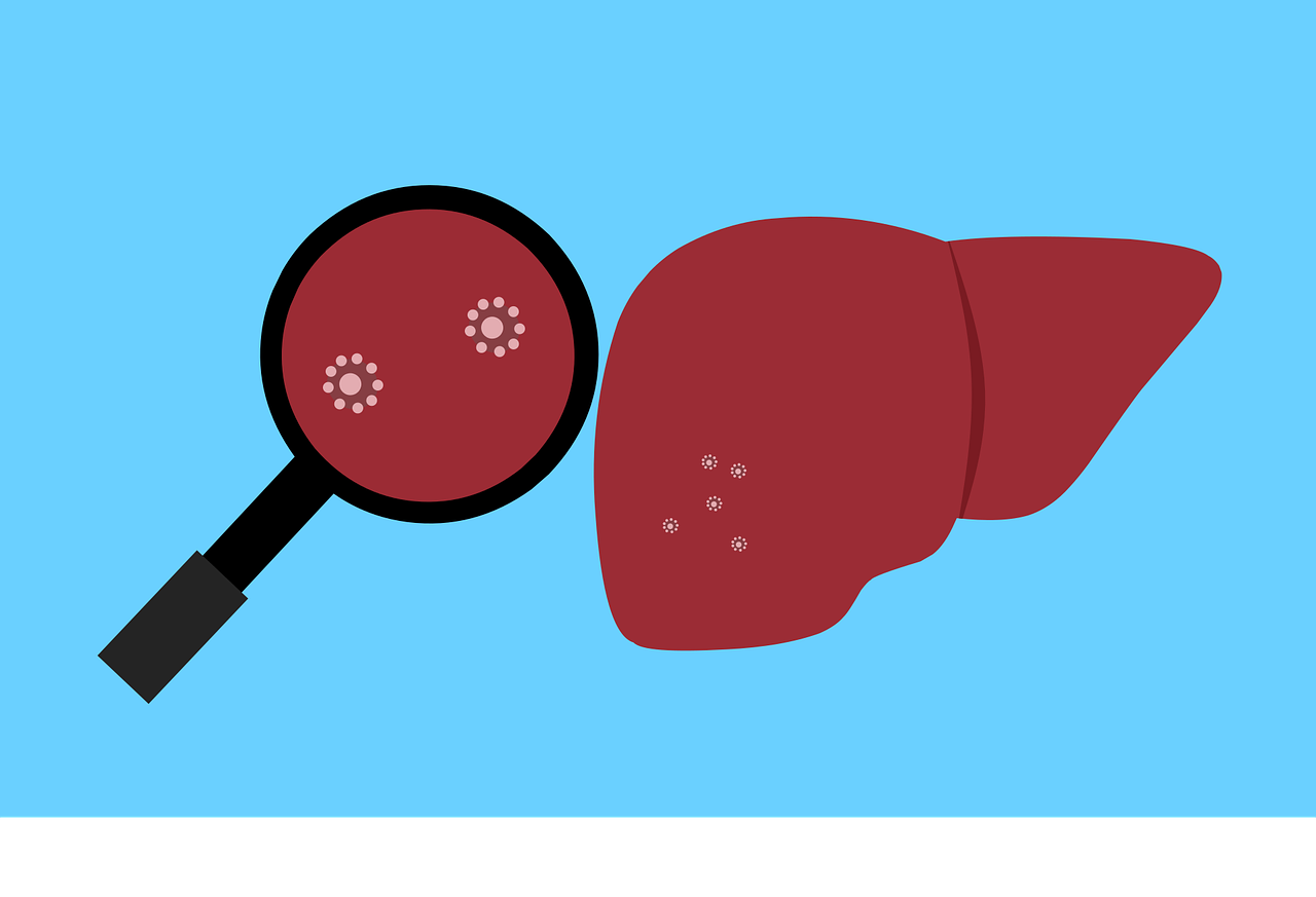 UPDATE privind inflamaţia hepatică acută de origine necunoscută la copii