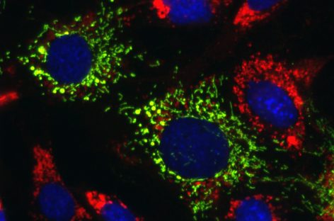 Cercetătorii au identificat o posibilă cale de a trata bolile neurologice ereditare