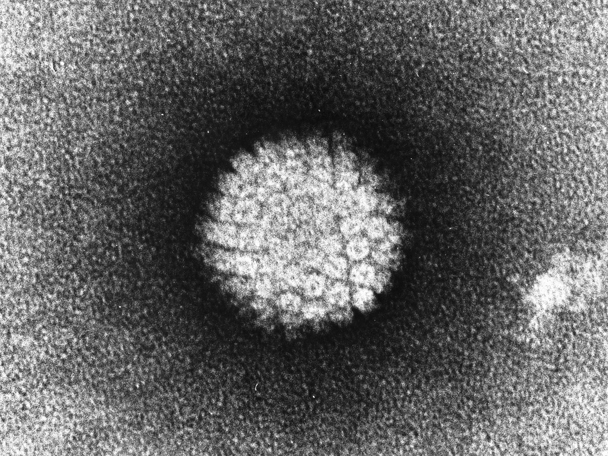 Cercetătorii au găsit un posibil răspuns de ce unii pacienţi au rezultate mai bune la tratament decât alţii în cazul cancerelor de cap şi gât legate de HPV
