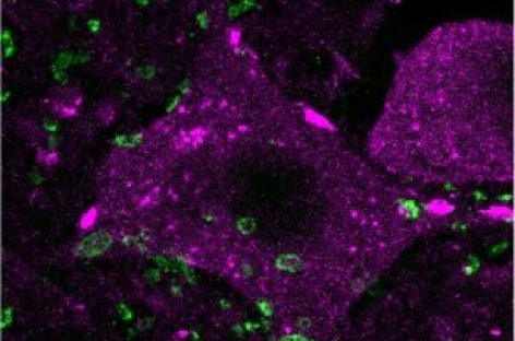 Tratament epigenetic îmbunătăţeşte regenerarea măduvei la şoarecii cu leziuni