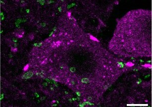 Tratament epigenetic îmbunătăţeşte regenerarea măduvei la şoarecii cu leziuni