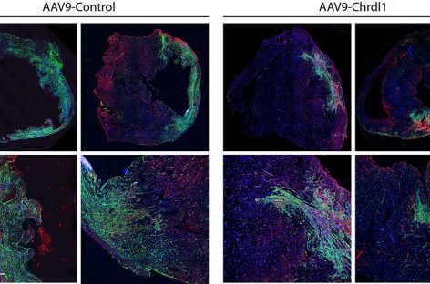 Trei proteine cu potenţial pentru prevenirea insuficienţei cardiace după un infarct, identificate de cercetători