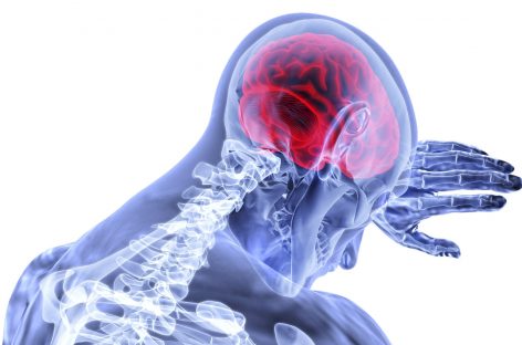 Reducerea riscului de AVC: Asociaţia Americană pentru Accidente Vasculare Cerebrale şi-a actualizat recomandările, pentru prima dată într-un deceniu