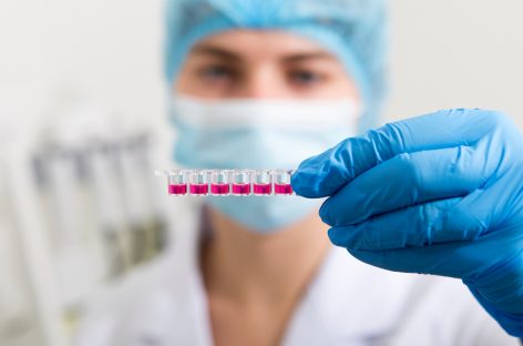 Test de rutină capabil să detecteze pacienţii cu risc crescut de cancer de sânge