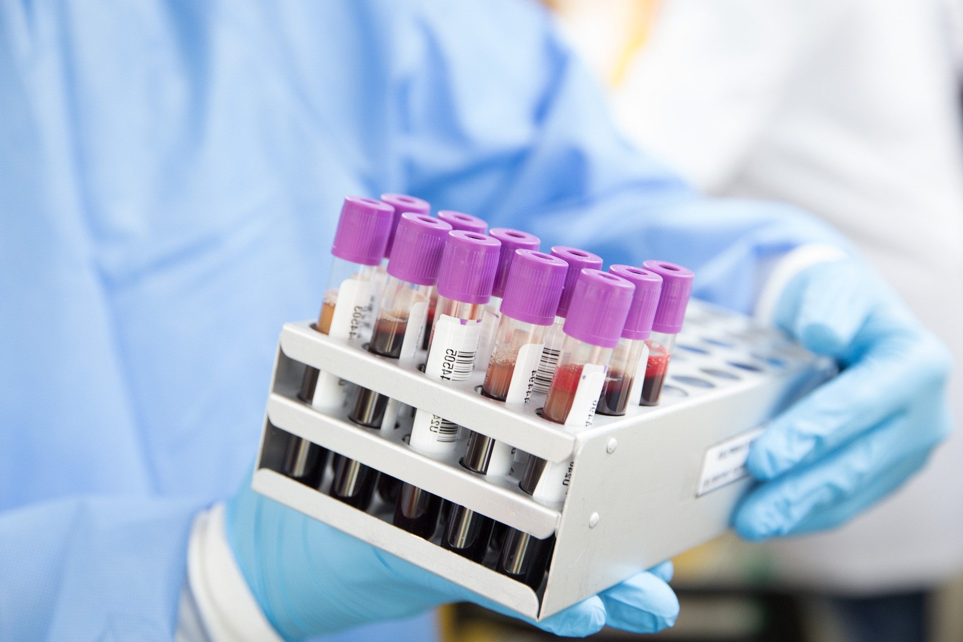 Un test de sânge poate detecta mai devreme mai multe tipuri de cancer