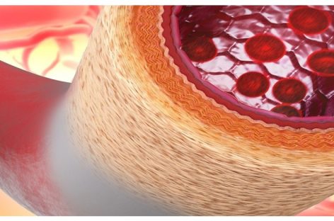 O tehnologie nouă permite producerea unui material care imită structura vaselor de sânge