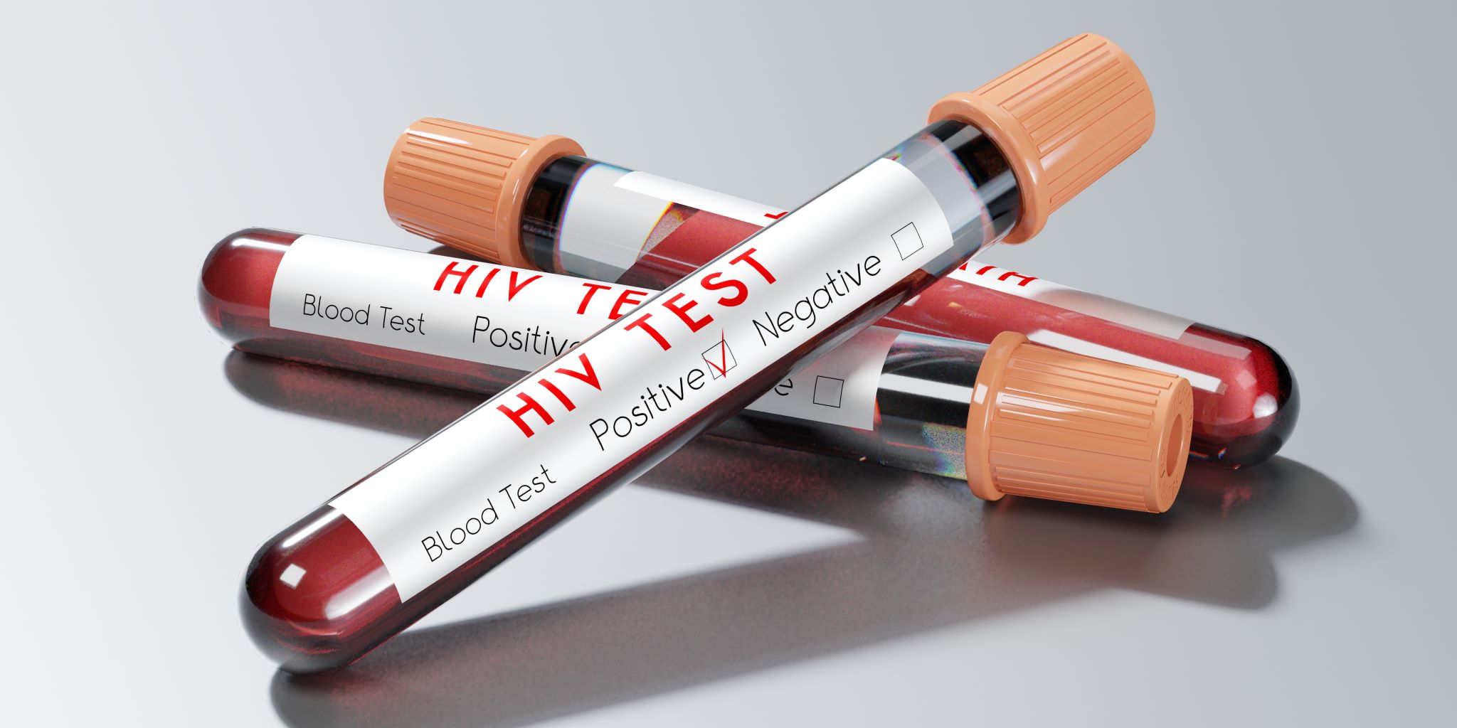 Cazul unic al pacientului din Geneva, aflat în remisie HIV, prezentat în prestigioasa revistă ştiinţifică Nature Medicine