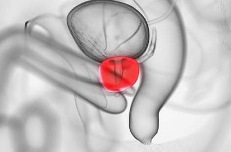 Dezvoltarea unei terapii pentru cancerul de prostată rezistent la tratament: un studiu clinic restrâns indică o supravieţuire fără progresie de 40%
