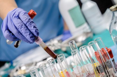 Sânge dezvoltat în laborator, transfuzat în premieră la om