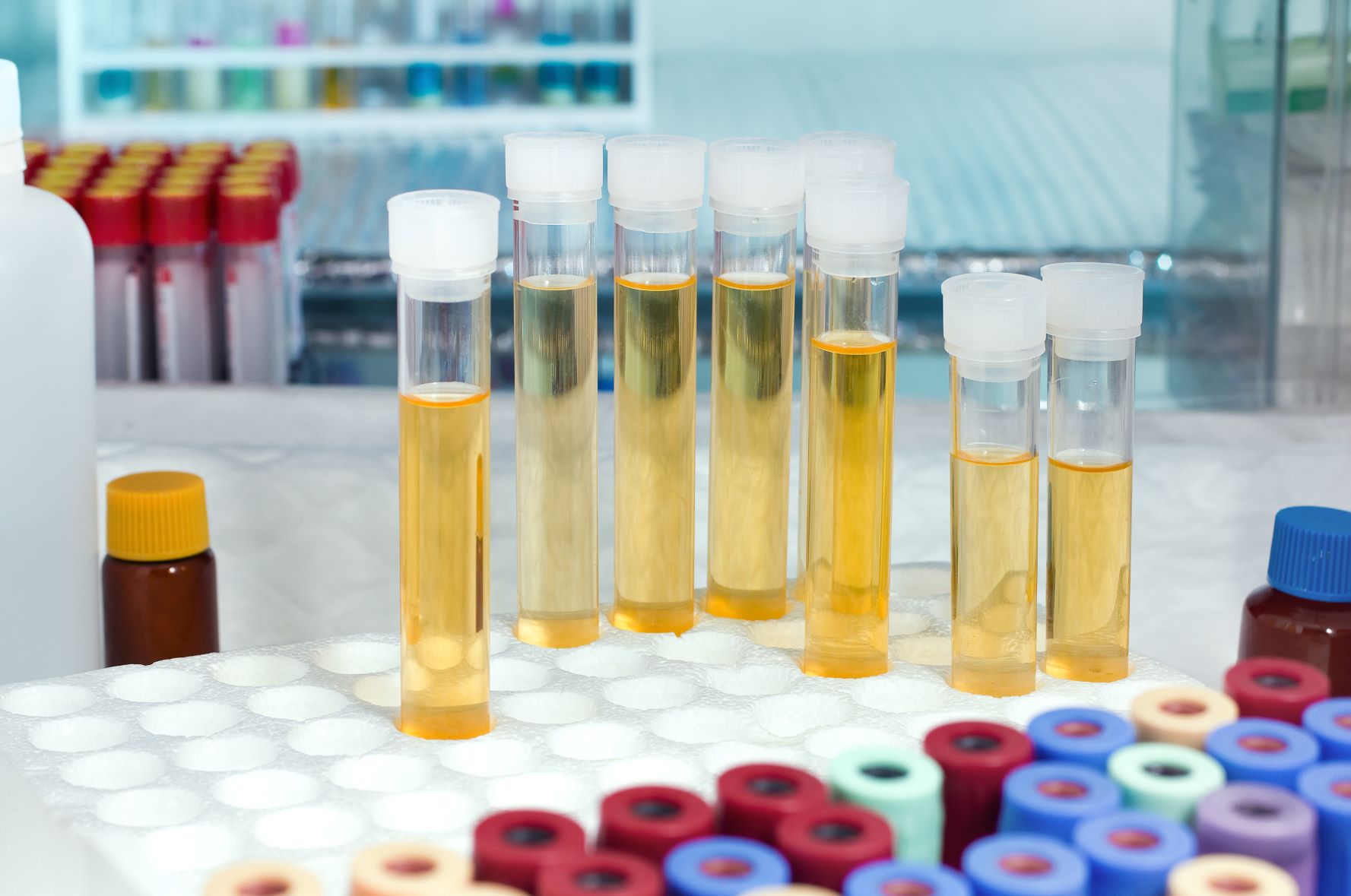 Un posibil vaccin la orizont împotriva bacteriilor care cauzează infecţiile urinare