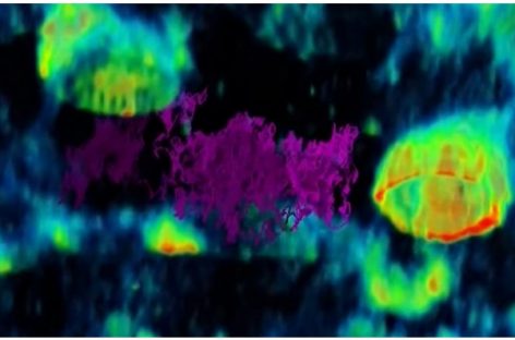Pentru prima dată, un virus e filmat cum „pândeşte” să intre în celulele umane