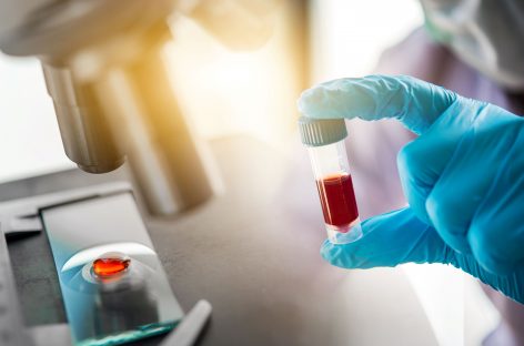 A început primul studiu clinic cu sânge obţinut în laborator