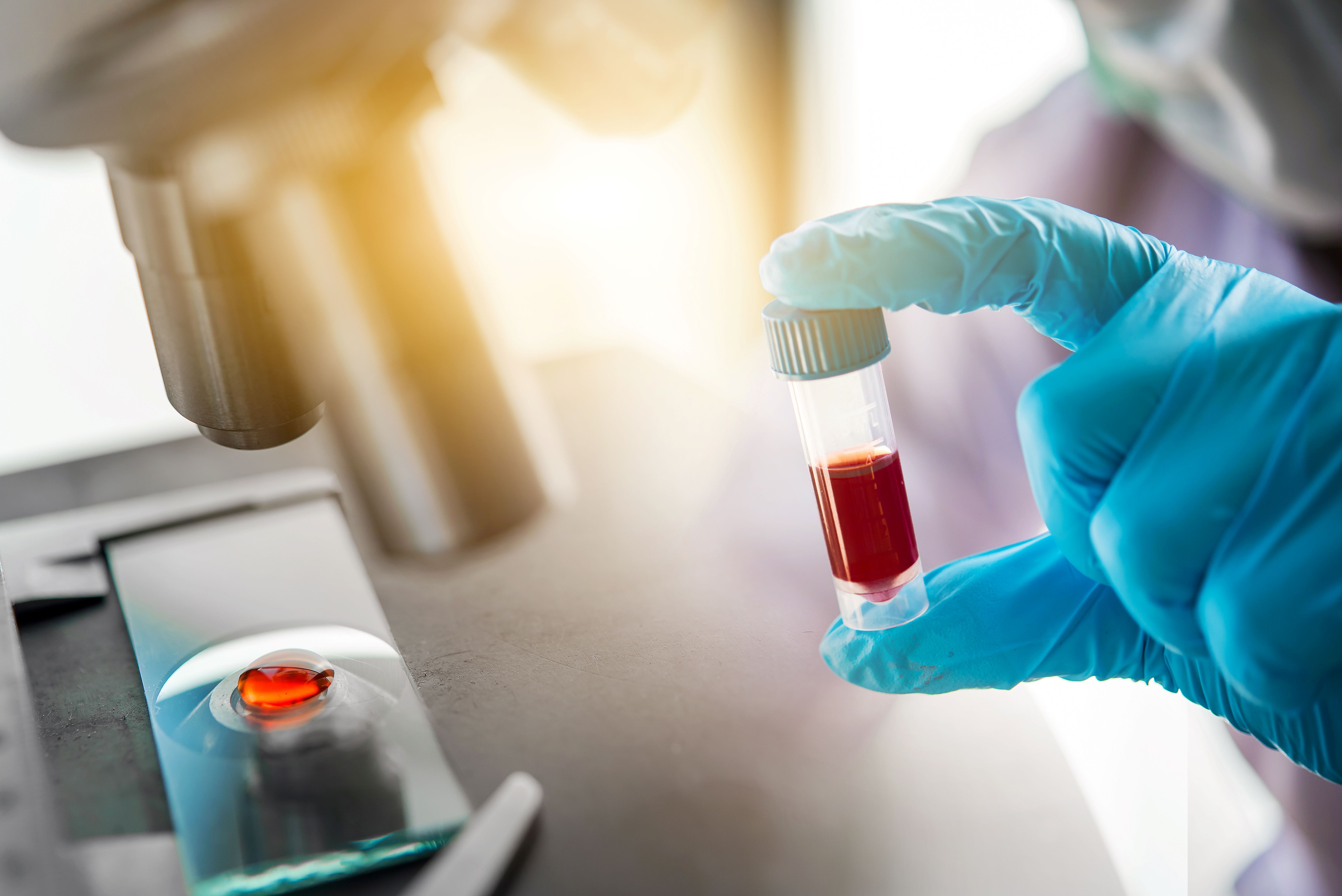 A început primul studiu clinic cu sânge obţinut în laborator