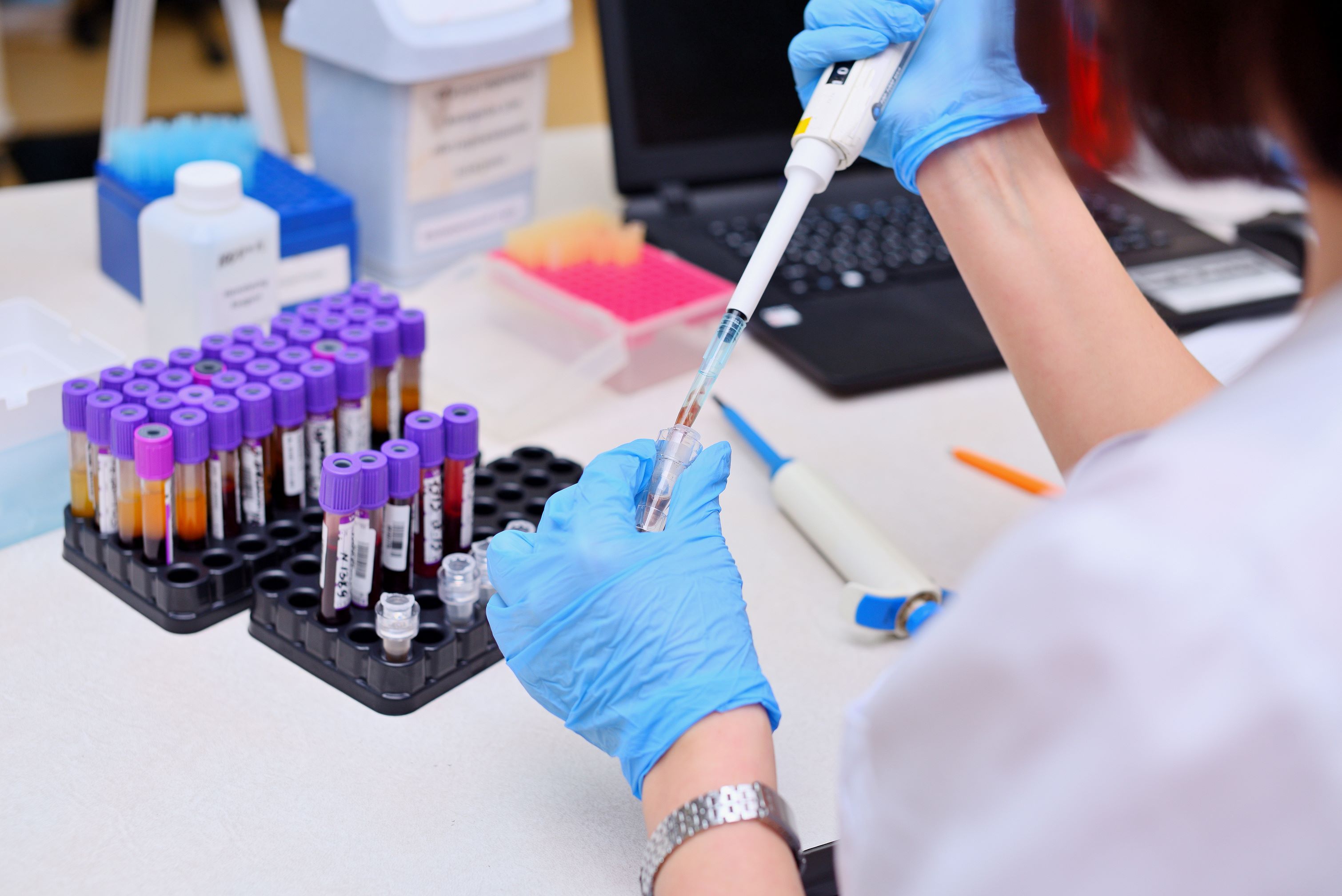 Test de sânge la domiciliu pentru depistarea Alzheimer, lansat în SUA