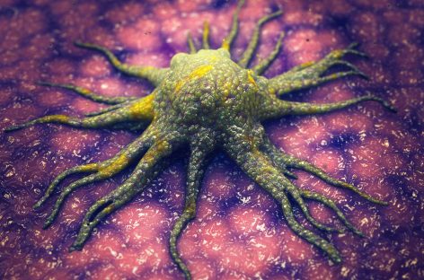 Originea cancerului: Când progresează o celulă către cancer? Poate fi oprită apariţia bolii?