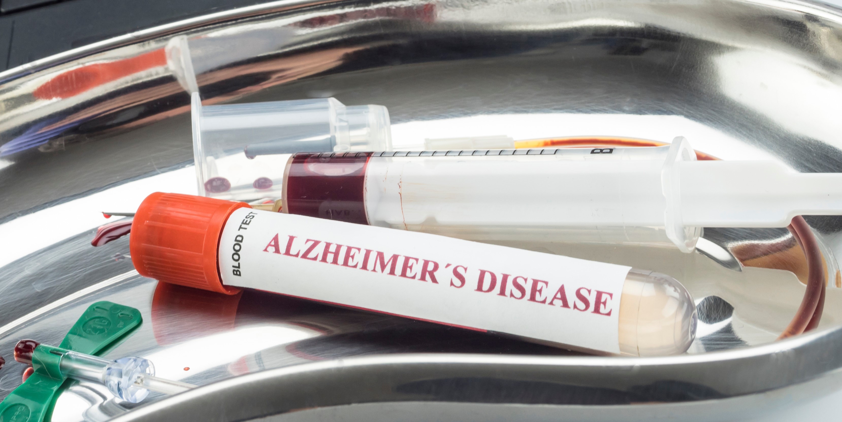 Noi markeri descoperiţi în sânge ar putea indica boala Alzheimer cu zece ani înainte de apariţia simptomelor