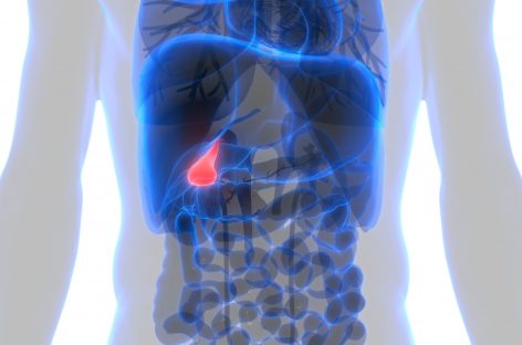 O nouă terapie de precizie pentru cancerul de căi biliare poate prelungi viaţa pacienţilor