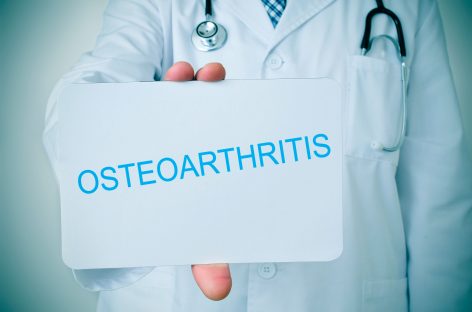 Descoperirea unui mecanism care conduce la osteoartrită ar putea ajuta la dezvoltarea de noi tratamente
