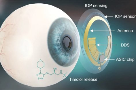 O lentilă de contact inteligentă care diagnostichează şi tratează glaucomul