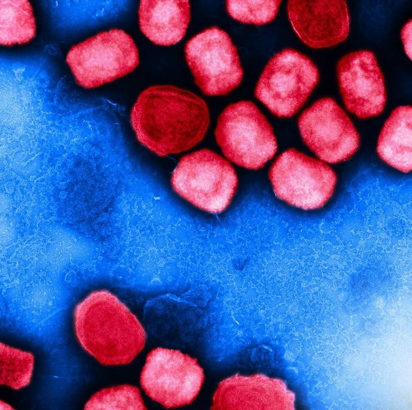 Formă severă de mpox identificată în cazurile avansate de HIV