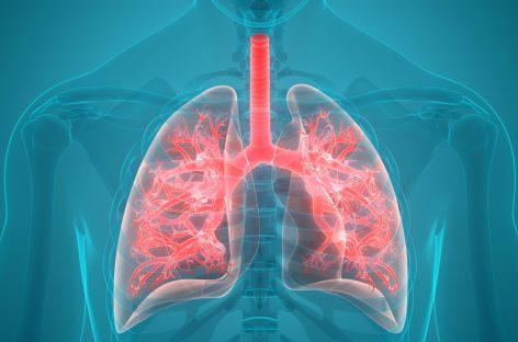 Transplantul de celule pulmonare proprii, posibil tratament pentru o boală respiratorie severă