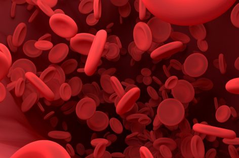 Legătură genetică necunoscută până acum între trombocitele din sânge şi Parkinson, identificată de cercetători