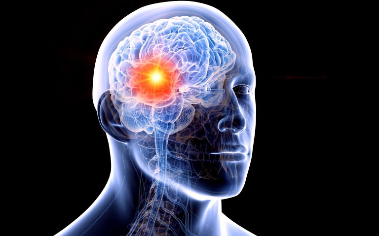 Marker molecular poate estima cu exactitate recurenţa meningioamelor agresive