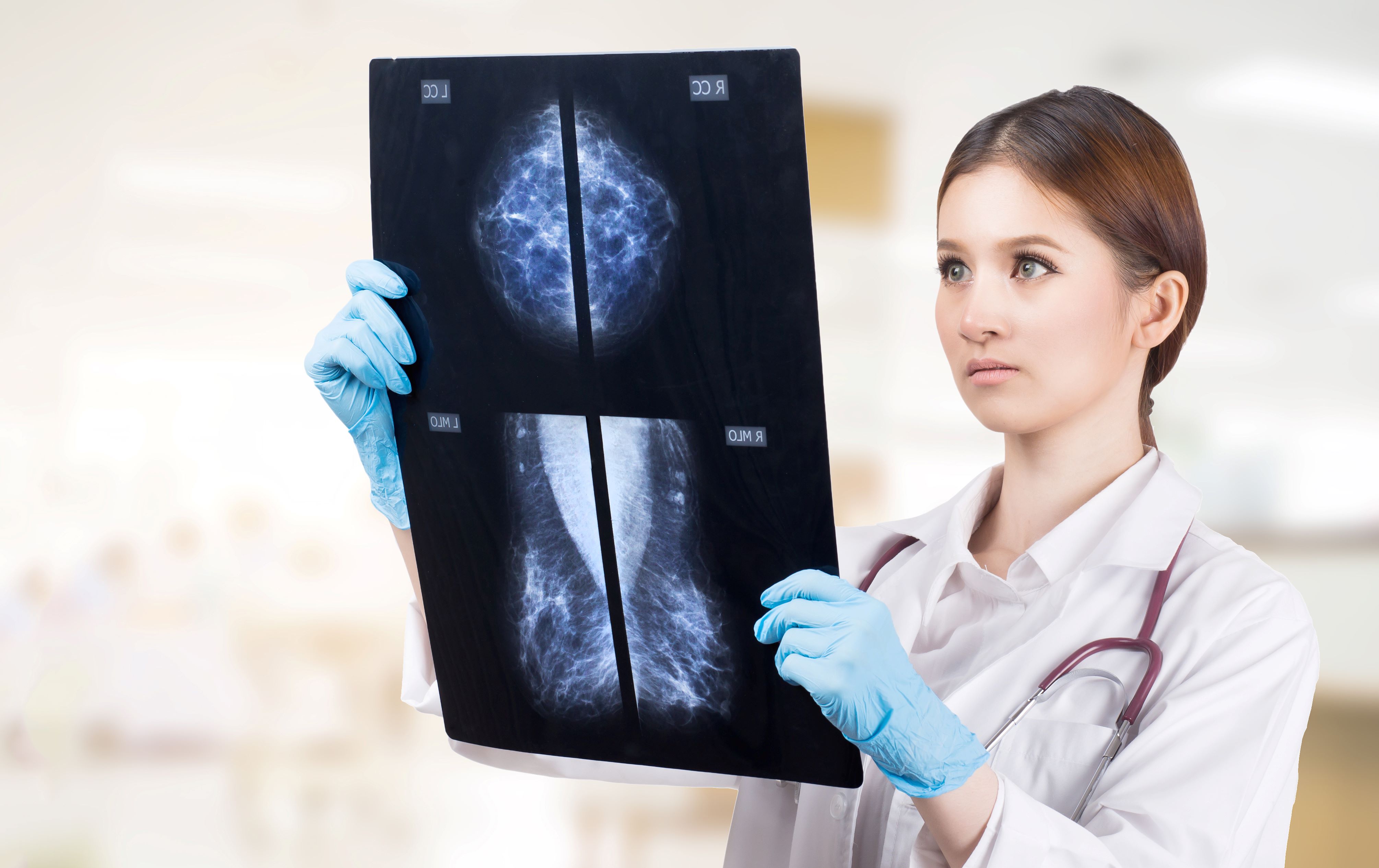 Statistică surprinzătoare la nivelul UE: România stă mai bine decât Franţa şi Germania la dotarea cu aparatură pentru mamografie