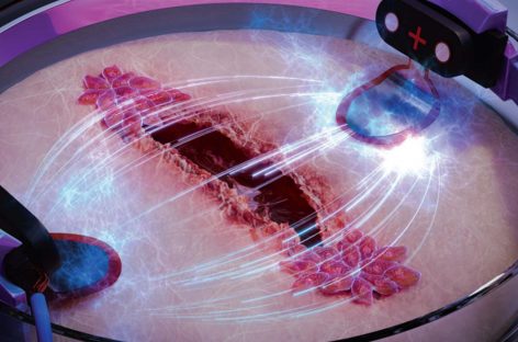 VIDEO Cum se pot vindeca mai rapid rănile