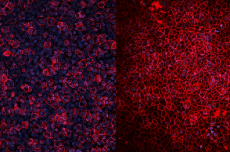 Oamenii de ştiinţă au creat mini-plămâni umani pentru cercetarea bolilor şi testarea de medicamente