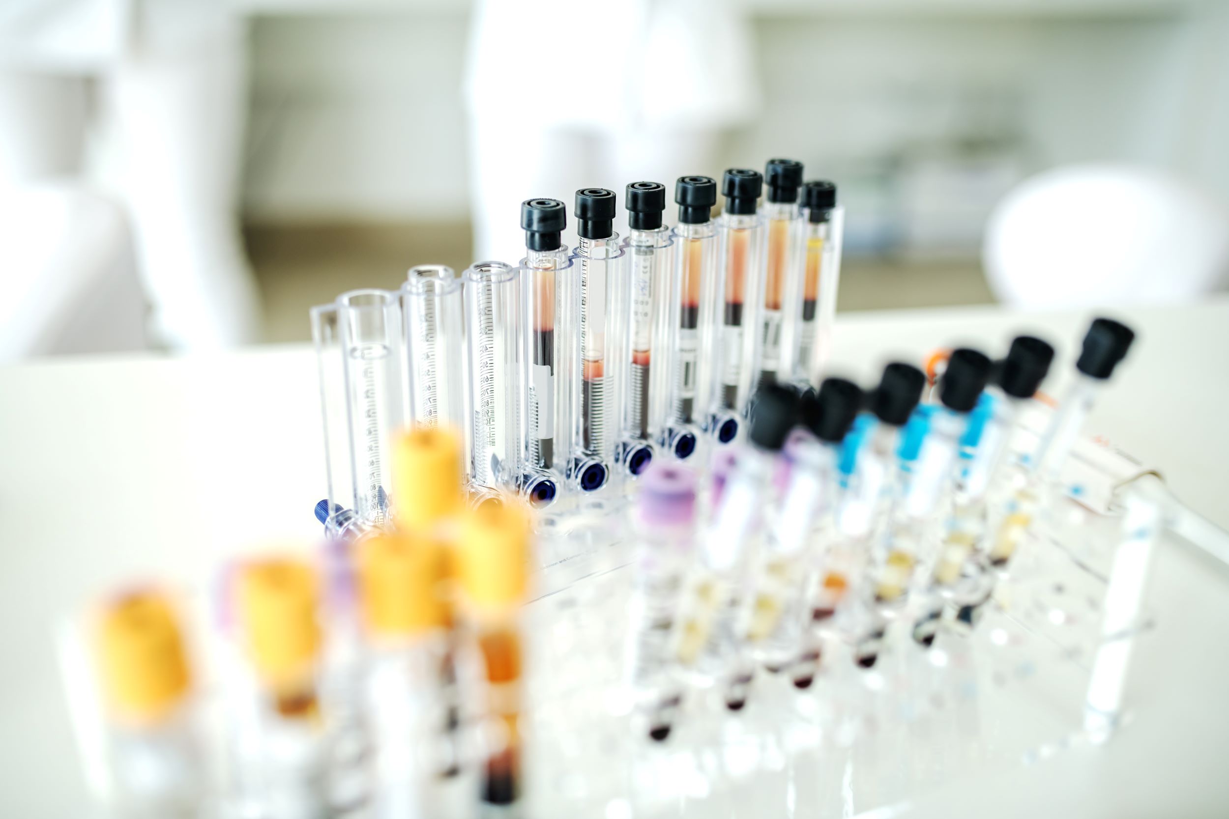 Test seric din sânge pentru diagnosticarea bolilor neurodegenerative