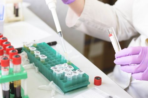 Nouă ţintă potenţială de tratament pentru sepsis şi lupus