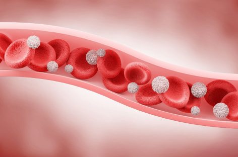 Celule nou descoperite ar putea fi responsabile de complicaţiile aterosclerozei