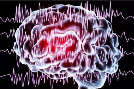 Un nou circuit cerebral pentru epilepsie, descoperit de cercetători