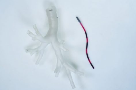 VIDEO Miniroboţii chirurgicali ar putea transforma detectarea şi tratamentul cancerelor